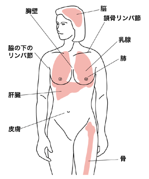 図：乳がんの再発・転移しやすい臓器