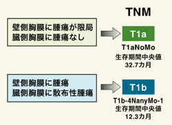 図：T1aとT1bの違い