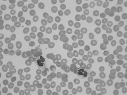 白血球数が7400の健常人の血液標本