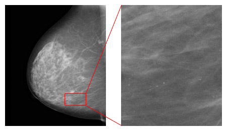 写真：最新乳房X線撮影装置で撮影されたマンモグラフィ