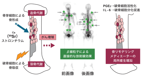 図：骨転移部に集まるメタストロンと痛みを緩和する作用〕