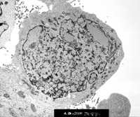 ヒト前立腺がん細胞
