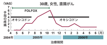 図:末梢神経障害に対するオキシコドンの効果例(代表的な症例)