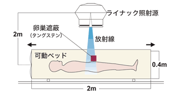 図：東大病院の全身放射線照射の方法