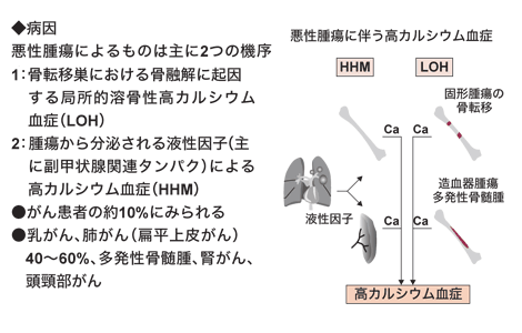 図:腫瘍随伴症候群の中で最も多く起こる高カルシウム血症