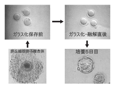 ガラス化凍結法による凍結保存前後の卵子