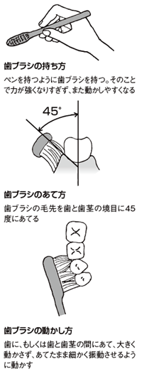 自分でできる正しい口腔ケアの仕方
