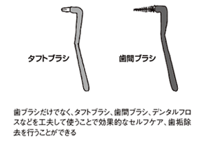 歯ブラシ以外の清掃補助用具