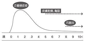 図4 皮膚障害の出現時期(セツキシマブによって起こる皮膚障害の典型例)