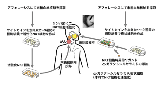 図:頭頸部がんに対するNKT細胞免疫療法