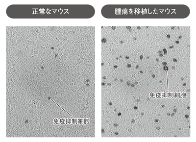 写真1：免疫抑制細胞の数の比較