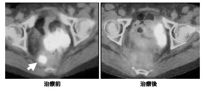 治療前/治療後