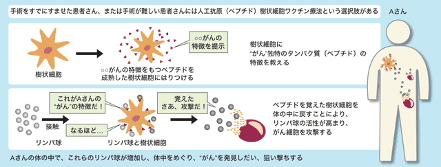 図：人工抗原樹状細胞ワクチン療法とは