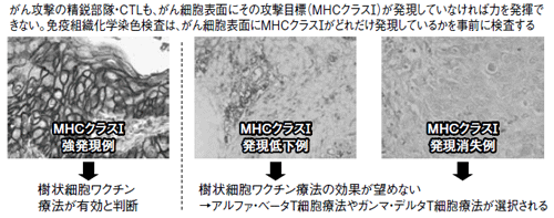 図4 免疫組織化学染色検査