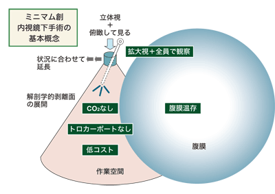 図：ミニマム創内視鏡下手術の基本概念
