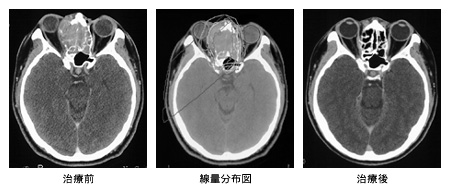 症例(2)