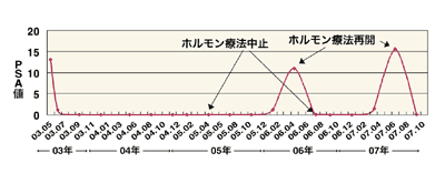 図:PSA値の推移(’03.05~’07.10)