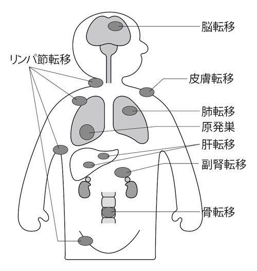 ç¹éEE¿å³9