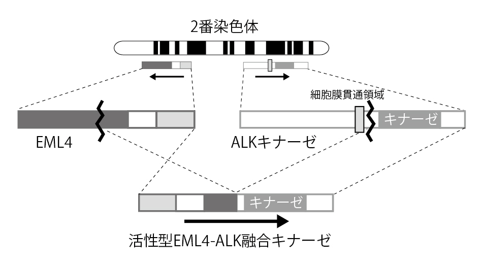 ■図1 EML4-ALK融合遺伝子の産生EML4遺伝子とALK遺伝子は2番染色体の近い位置に反対向きに存在する。しかし両遺伝子を挟む領域がちぎれてひっくり返ることで、EML4とALKが融合したがん遺伝子が生じ、結果的にがん細胞の増殖を促してしまう