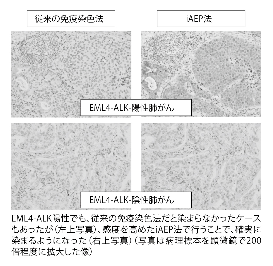 ■写真4 従来の免疫染色法とiAEP法との違い