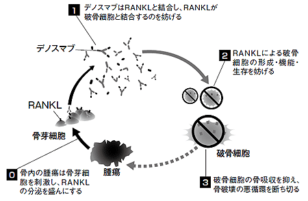 ■図4 デノスマブの作用