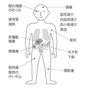 ■図7 グリベックの主な副作用について ■図7 グリベックの主な副作用について