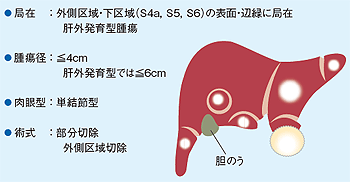 腹腔鏡下肝切除の適応範囲