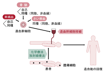 末梢血幹細胞移植