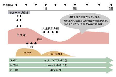 悪性リンパ腫に対する自己末梢血幹細胞移植の治療と経過
