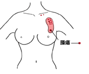 イラスト：腫瘤摘出術