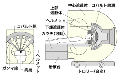 図:ガンマナイフの仕組み