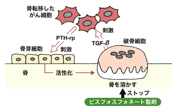 図：ビスフォスフォネート製剤の効果