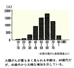 大腸がんの発病年齢 グラフ