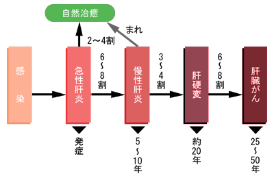 感染～肝臓がんへの移行