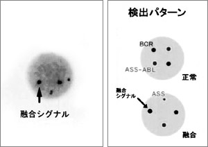 FISH法の染色体検出の図