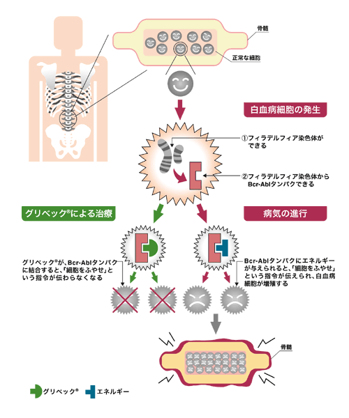 図：グリベックが効く仕組み