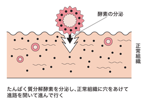 図：がん細胞の浸潤